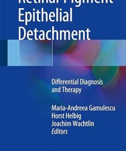 Retinal Pigment Epithelial Detachment