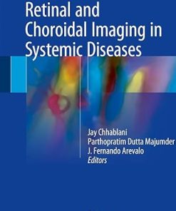 Retinal and Choroidal Imaging in Systemic Diseases