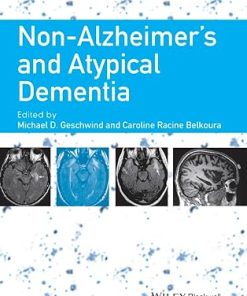 Non Alzheimers and Atypical Dementia