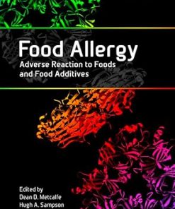 Food Allergy Adverse Reaction to Foods and Food Additives 5th Ed