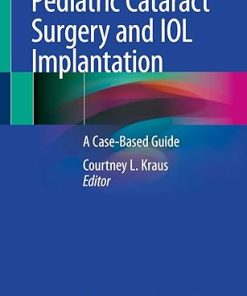 Pediatric Cataract Surgery and IOL Implantation