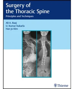 Surgery of the Thoracic Spine Principles and Techniques