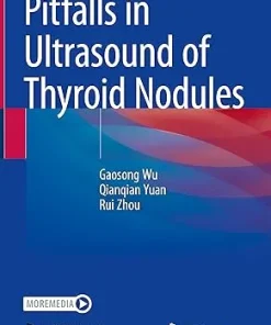 Pitfalls in Ultrasound of Thyroid Nodules