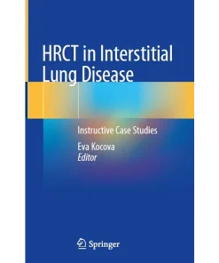 HRCT in Interstitial Lung Disease Instructive Case Studies