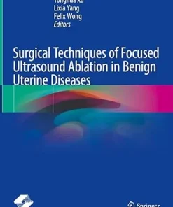 Surgical Techniques of Focused Ultrasound Ablation in Benign Uterine Diseases