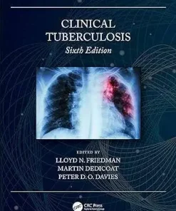 Clinical Tuberculosis 6th Edition