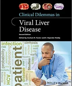 Clinical Dilemmas in Viral Liver Disease 2nd Edition