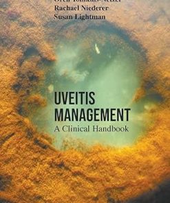 Uveitis Management