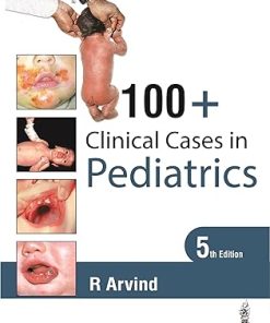 100+ Clinical Cases in Pediatrics
