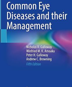 Common Eye Diseases and Their Management