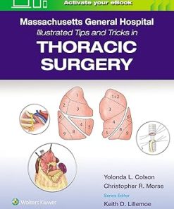 Thoracic Surgery