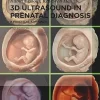 3D Ultrasound in Prenatal Diagnosis A Practical Approach 2nd Edition
