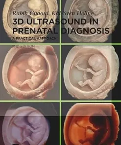 3D Ultrasound in Prenatal Diagnosis A Practical Approach 2nd Edition