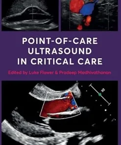 Point Of Care Ultrasound in Critical Care