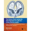 The Human Brain during the First Trimester 57- to 60-mm Crown-Rump Lengths