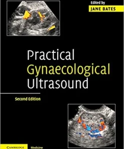 Practical Gynaecological Ultrasound 2nd Edition