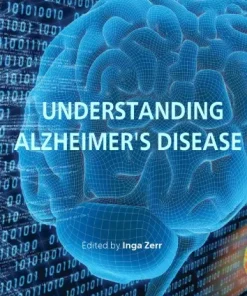 Understanding Alzheimers Disease