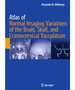Atlas of Normal Imaging Variations of the Brain Skull and Craniocervical Vasculature