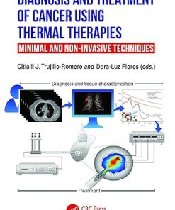Diagnosis and Treatment of Cancer using Thermal Therapies