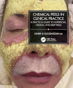 Chemical Peels in Clinical Practice