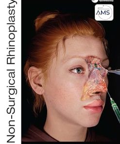 Non-Surgical Rhinoplasty