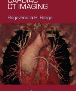 Introductory Guide to Cardiac CT Imaging