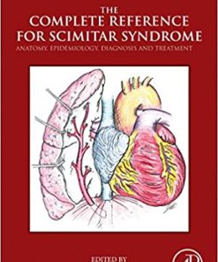 The Complete Reference for Scimitar Syndrome Anatomy Epidemiology Diagnosis and Treatment
