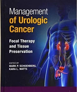 Management of Urologic Cancer Focal Therapy and Tissue Preservation