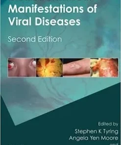 Mucocutaneous Manifestations of Viral Diseases