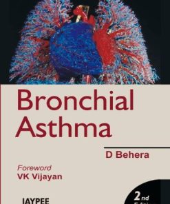 Childhood Asthma