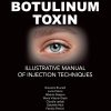 Botulinum Toxin Illustrative Manual of Injection Techniques